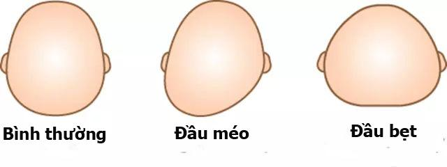 dau meo